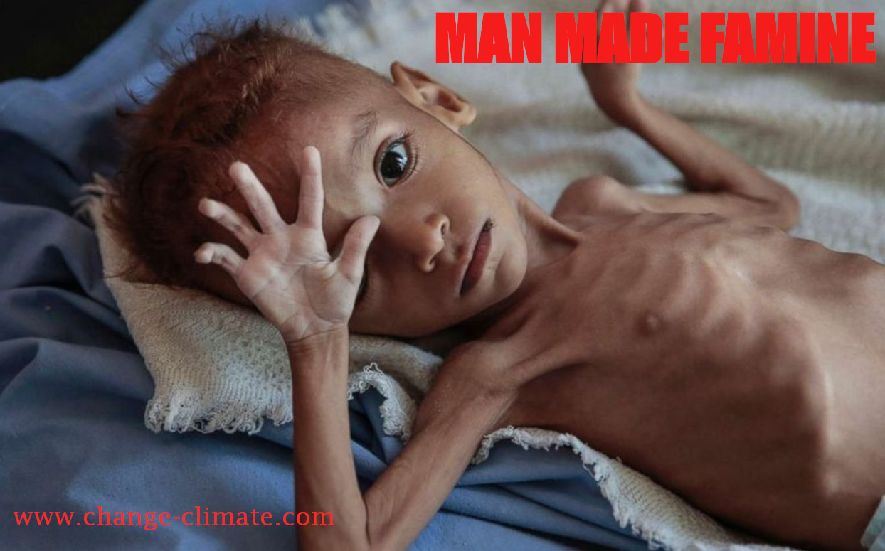 Man Made Famine is one of the by products of profiteering in business